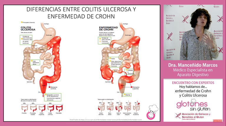 Dieta para enfermedad inflamatoria intestinal